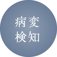 病変検知