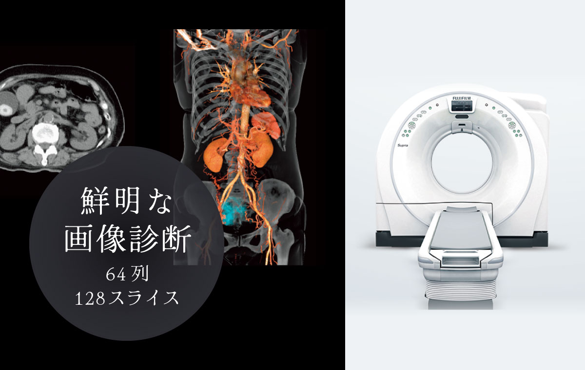 鮮明な画像診断：64列128スライス